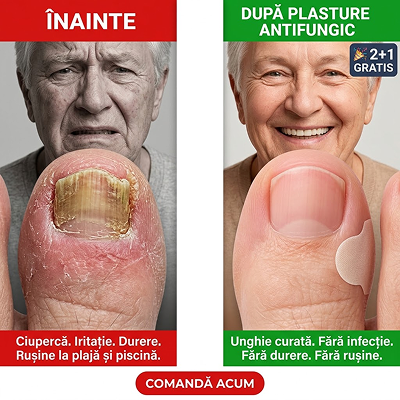 Înainte și după tratament